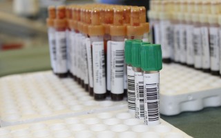 嫌疑人疑死亡后仍送医院抢救9天的深度探究