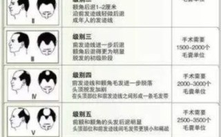 如何有效剔除粗大误差