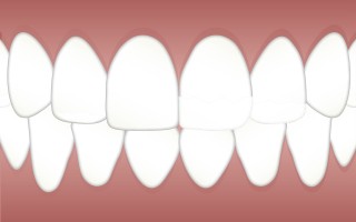 快速美白牙齿，科学方法与日常护理