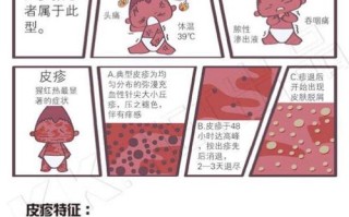 小儿垂钓的原因是什么
