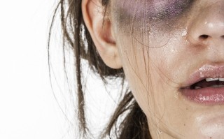 美白牙齿的秘诀，快速变白的小妙招与实用技巧