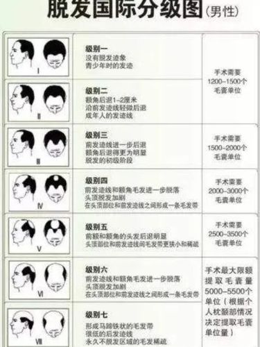 如何有效剔除粗大误差-第1张图片-彩蝶百科 如何有效剔除粗大误差-第1张图片-彩蝶百科